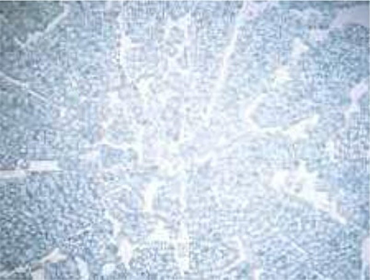 強化ガラスの割れ方